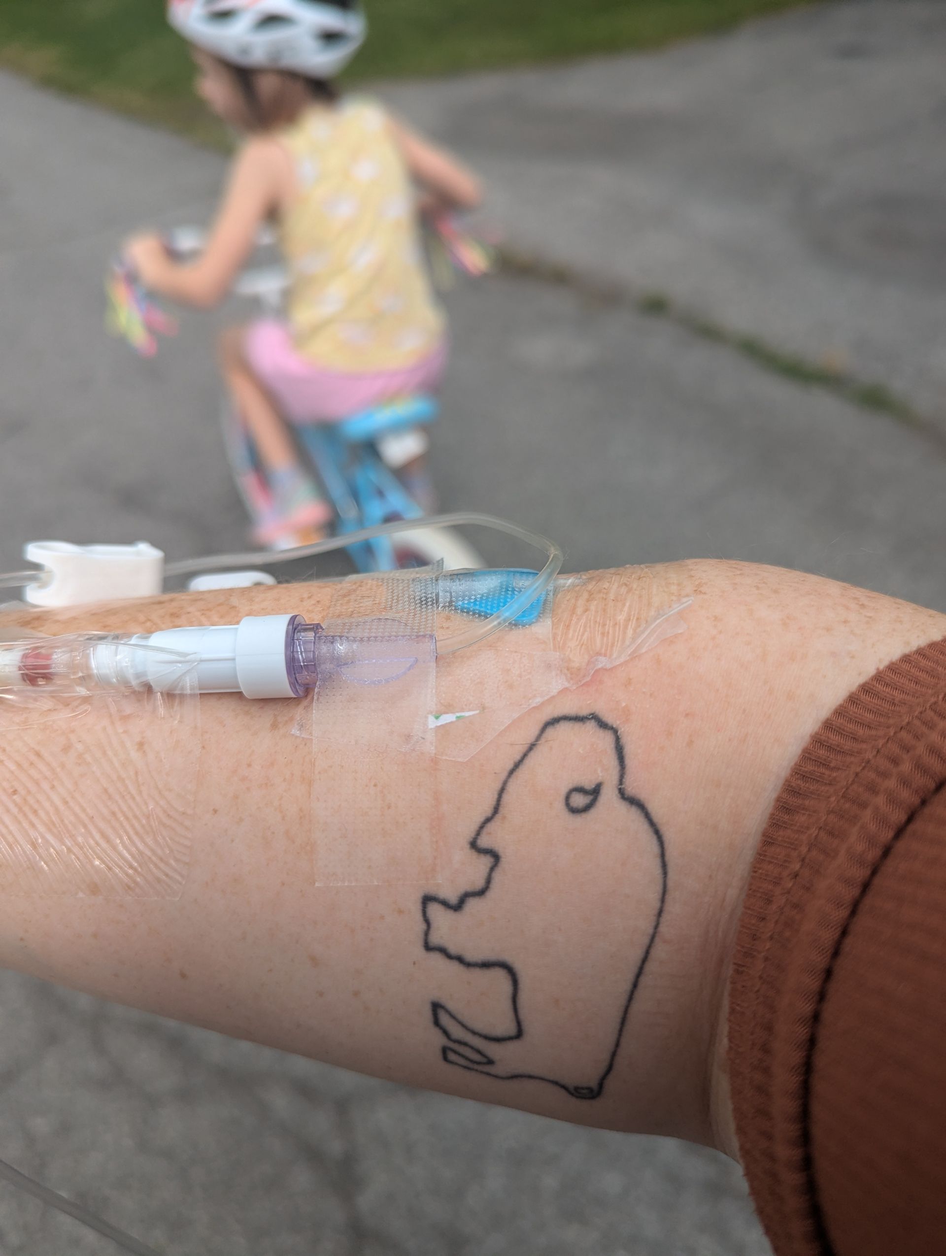 image of IV line in arm while therapist cares for her young child