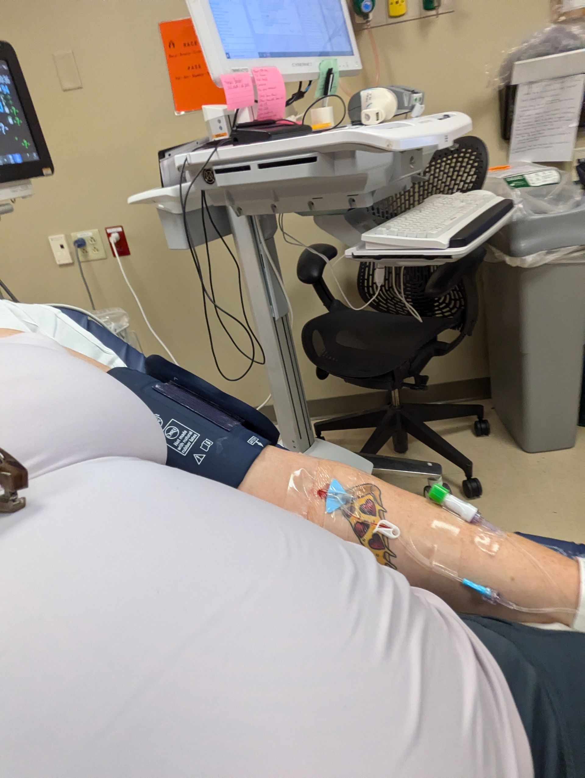 image of therapist laura ott receiving treatment for hyperemesis gravidarum