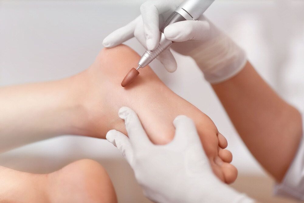 A Person Is Getting A Pedicure On Their Foot — Lake Macquarie Podiatry in Swansea, NSW