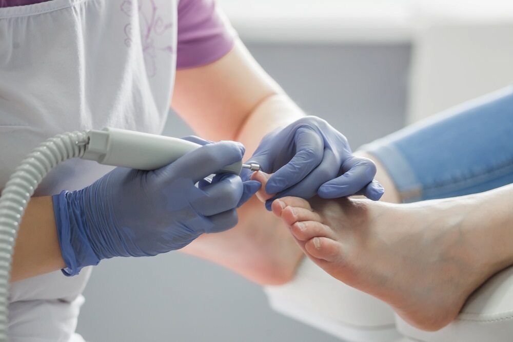 A Woman Is Getting Her Toenails Done By A Podiatrist — Lake Macquarie Podiatry in Belmont, NSW