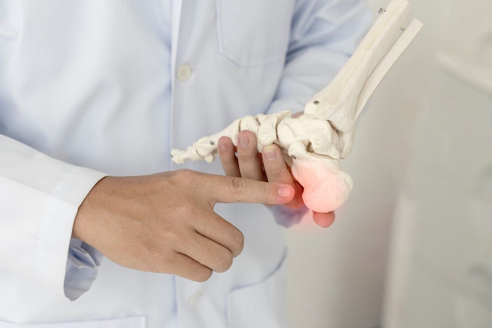 A Doctor Is Holding A Model Of A Skeleton Of A Foot — Lake Macquarie Podiatry in Belmont, NSW