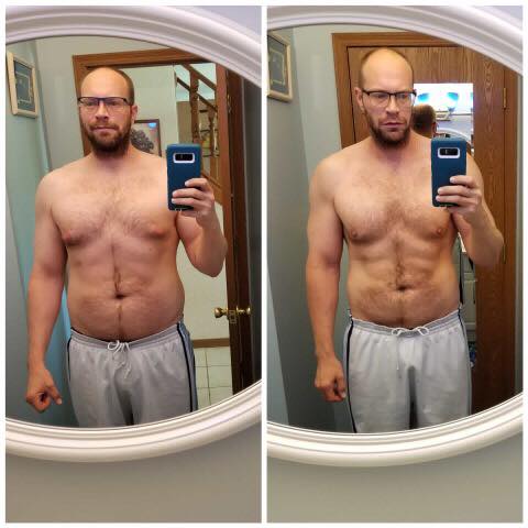 Before and After Fat Loss | Chesterfield, MO | Summit Rejuvenation Center