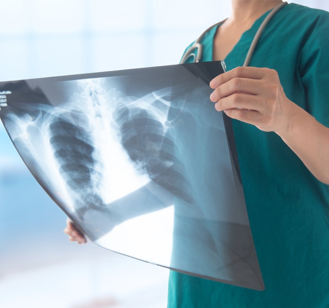 Un medico in camice verde mostra una radiografia del torace in un ambiente ospedaliero.