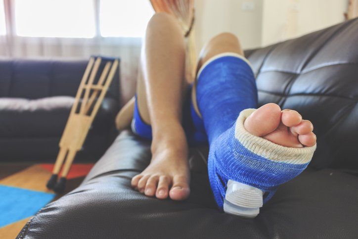 Broken Leg in a Plaster Cast — Dodge City, KS — Phillips Chiropractic & Physical Therapy Center