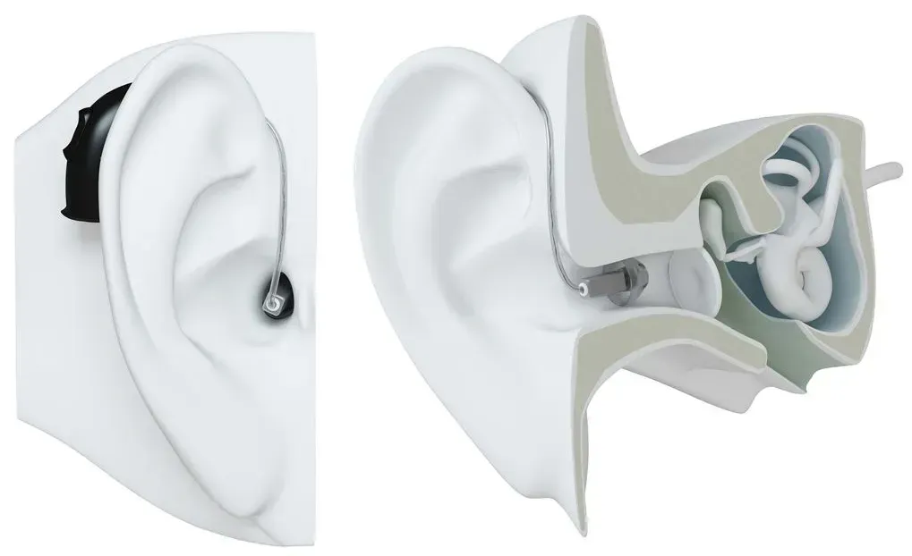 ReSound Behind the ear hearing Aid