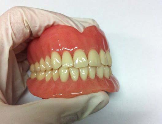 woman holding teeth mold