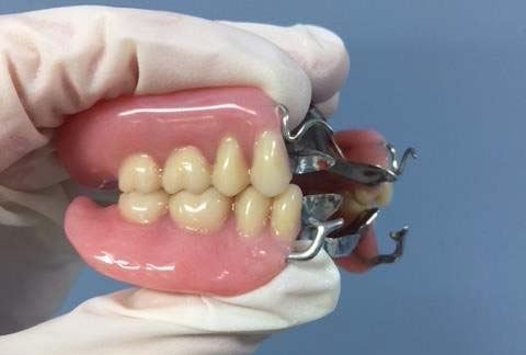 dentist holding partial dentures