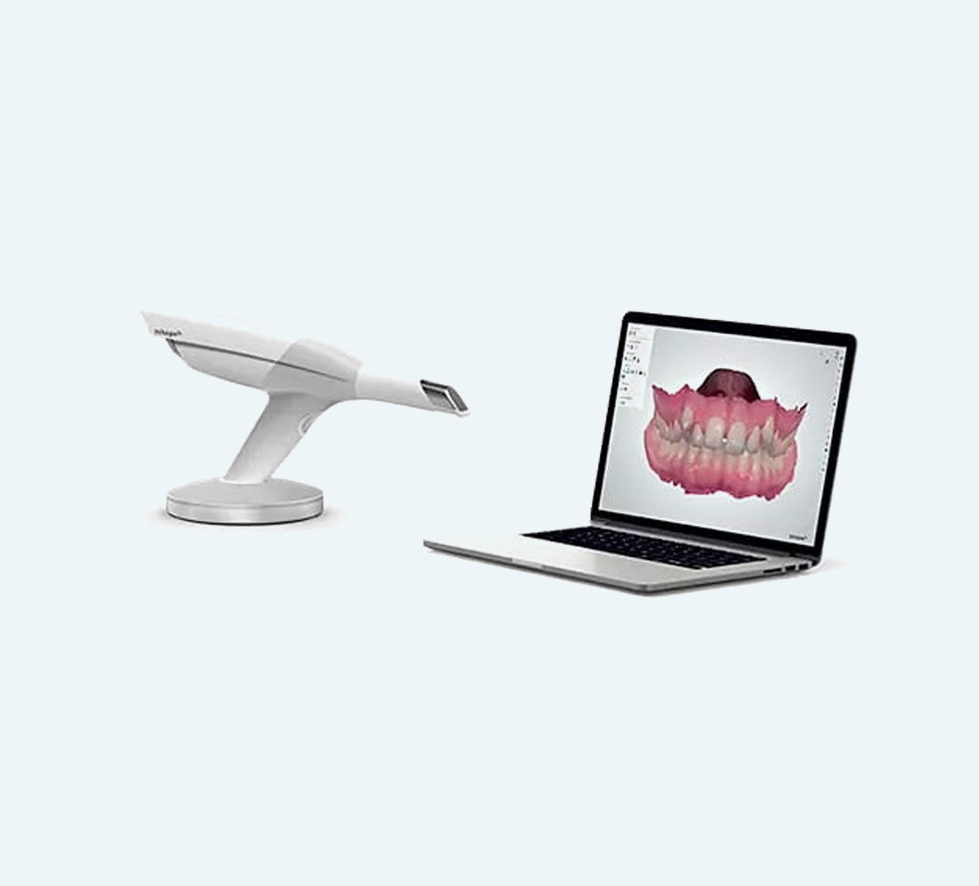 Dental scanner and laptop displaying a 3D dental scan of teeth.