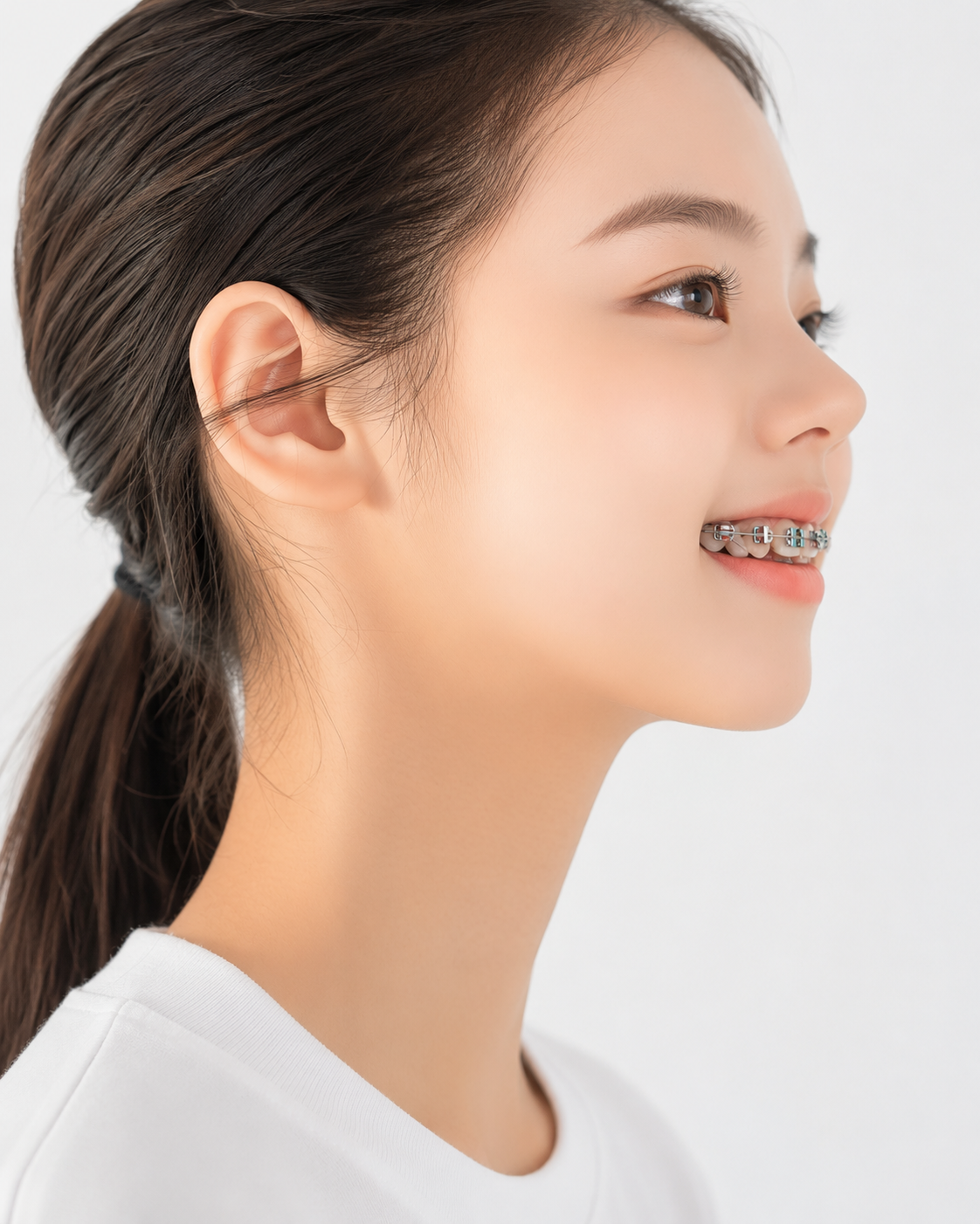 Orthodontic braces treatment at Baro Dental Clinic, Busan Seomyeon