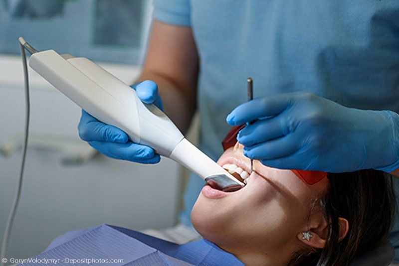 3D Scan der Zähne - kein Abdruck notwendig