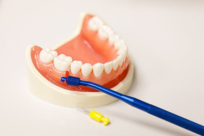 Zahnreinigung - auch Zwischenräume müssen sauber gehalten werden