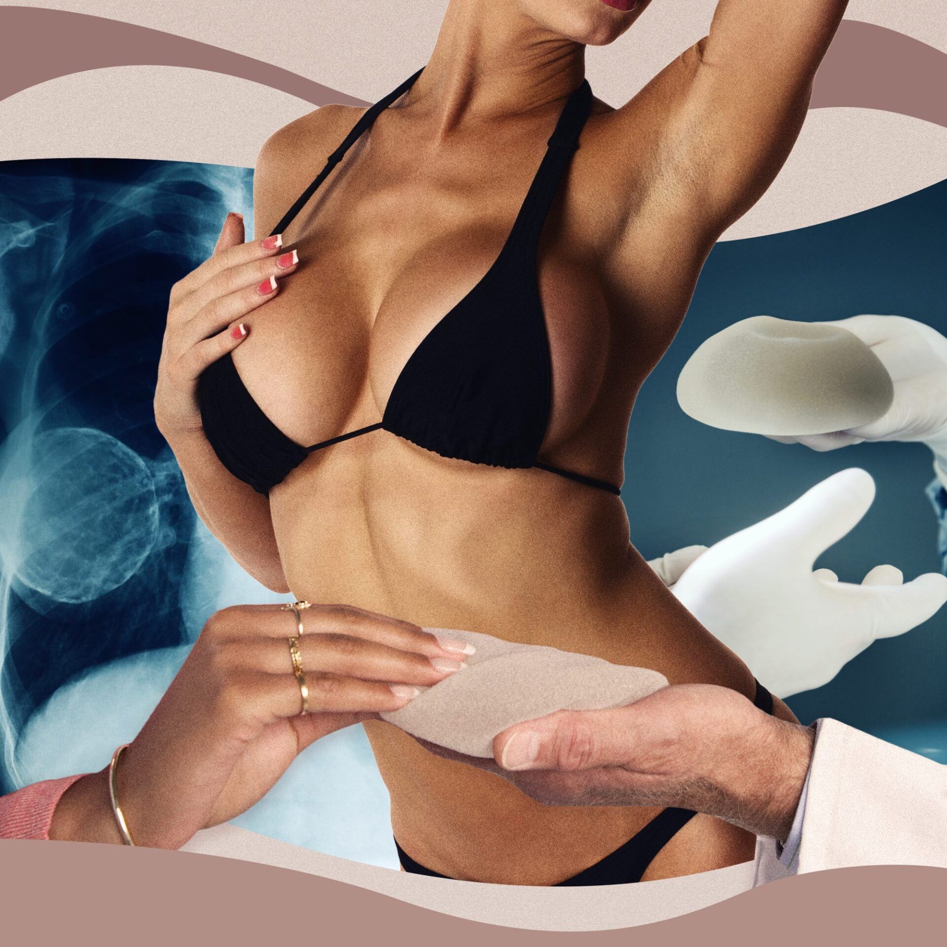 transformation aesthetic solutions, Breast Augmentation, Breast Lift, Breast Implants, Cosmetic Surgery, Breast Surgeon, Breast Reconstruction
