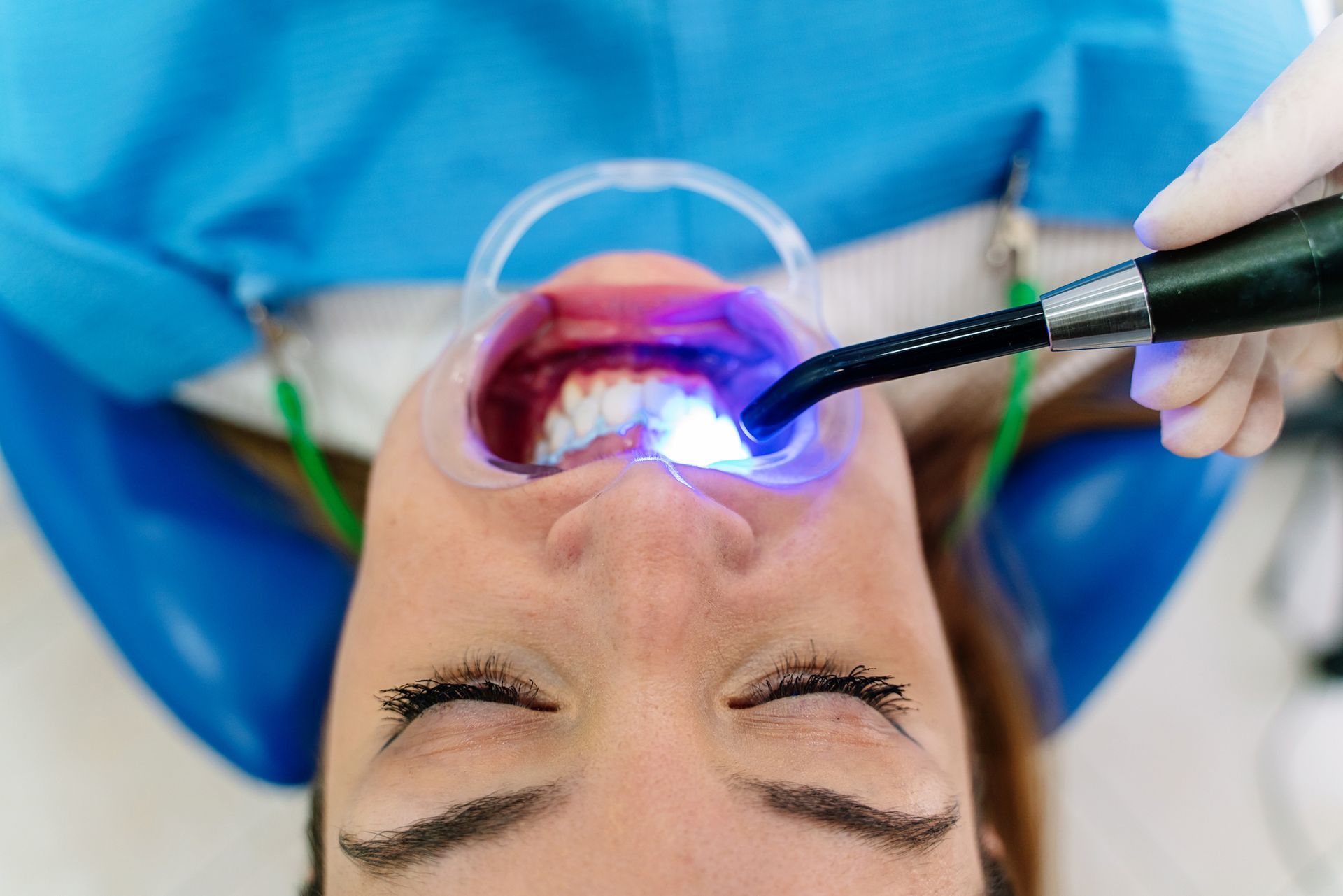 A woman receiving dental care services with a bright light, showcasing teeth whitening in progress.