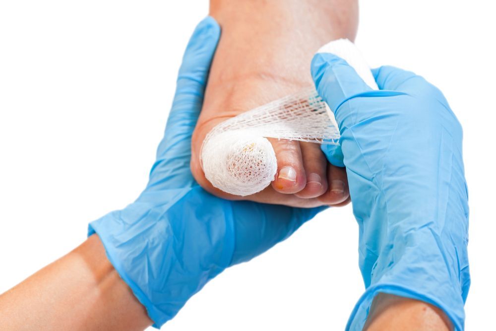A Person Is Getting a Bandage on Their Foot — Betta Foot Clinic in Calamvale, QLD