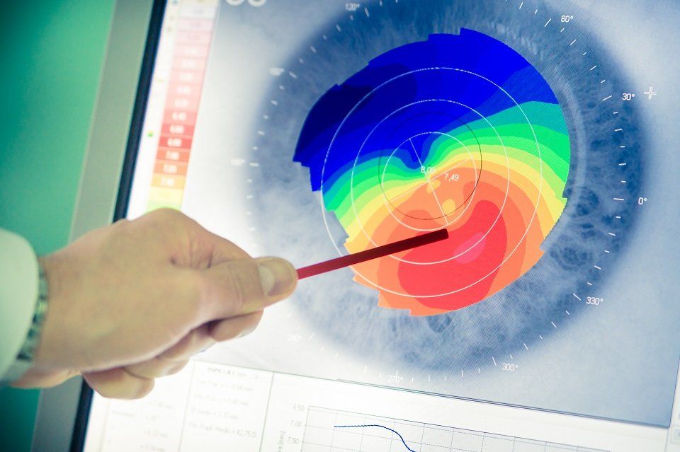 Oculista indica schermo con test del cheratocono