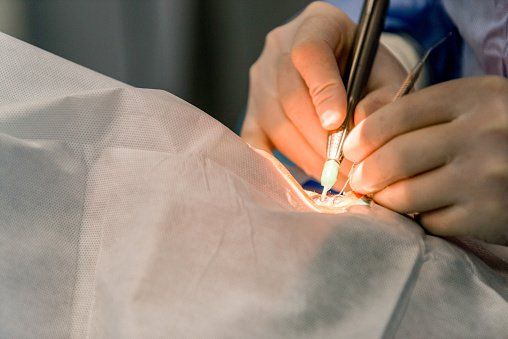 Intervento chirurgico agli occhi