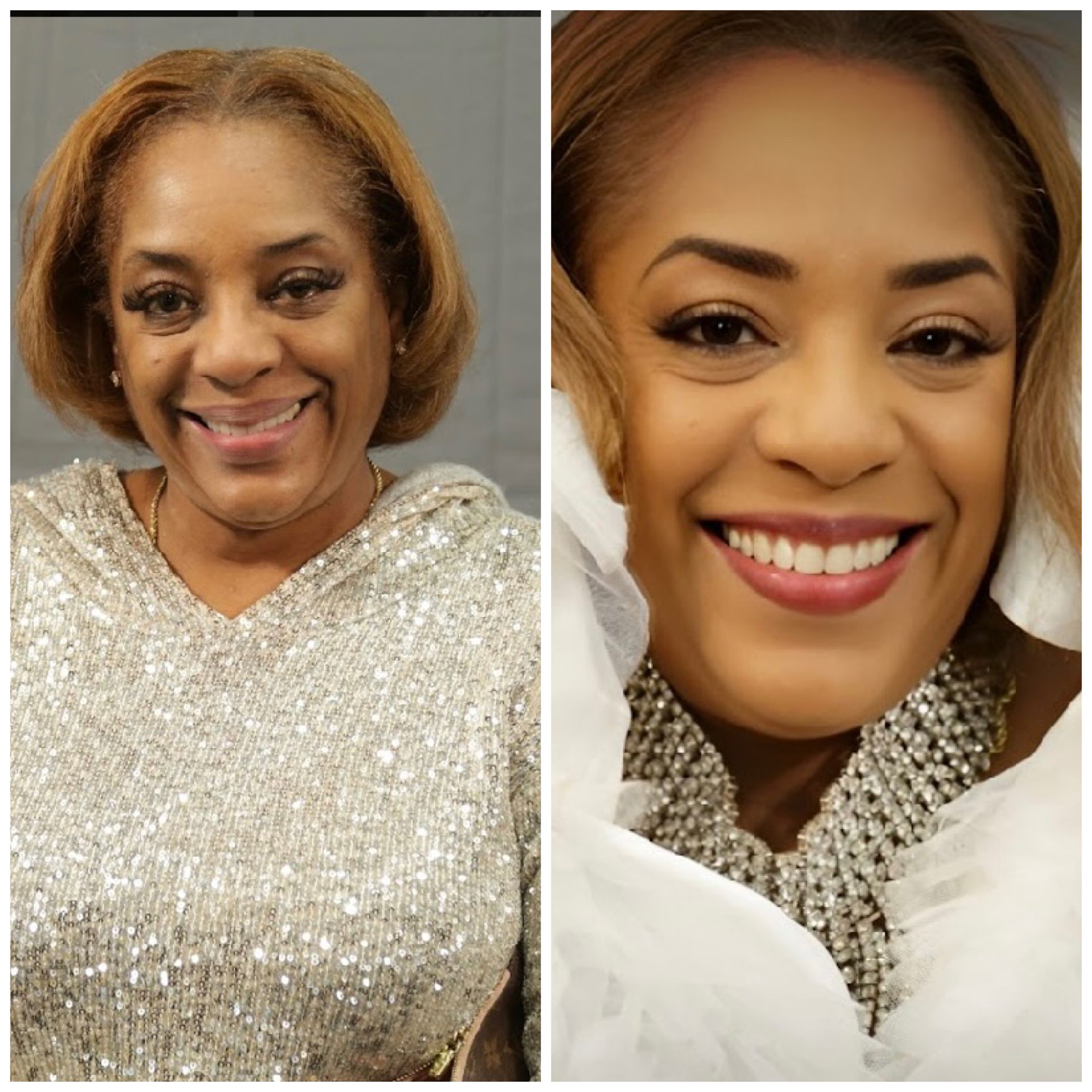 A before and after photo of a woman smiling