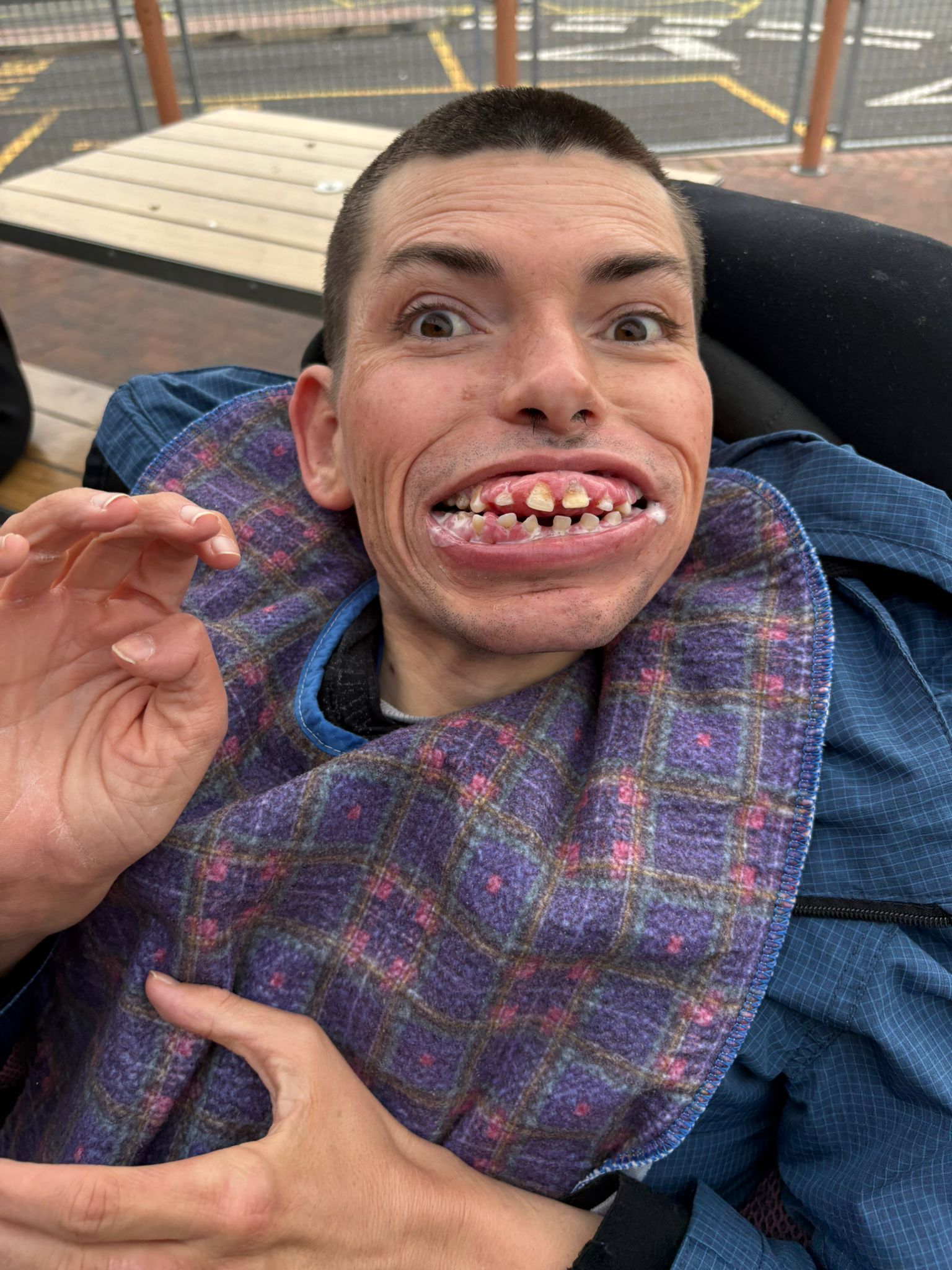 Man in wheelchair, wearing bib, smiling with teeth visible, making hand gesture.