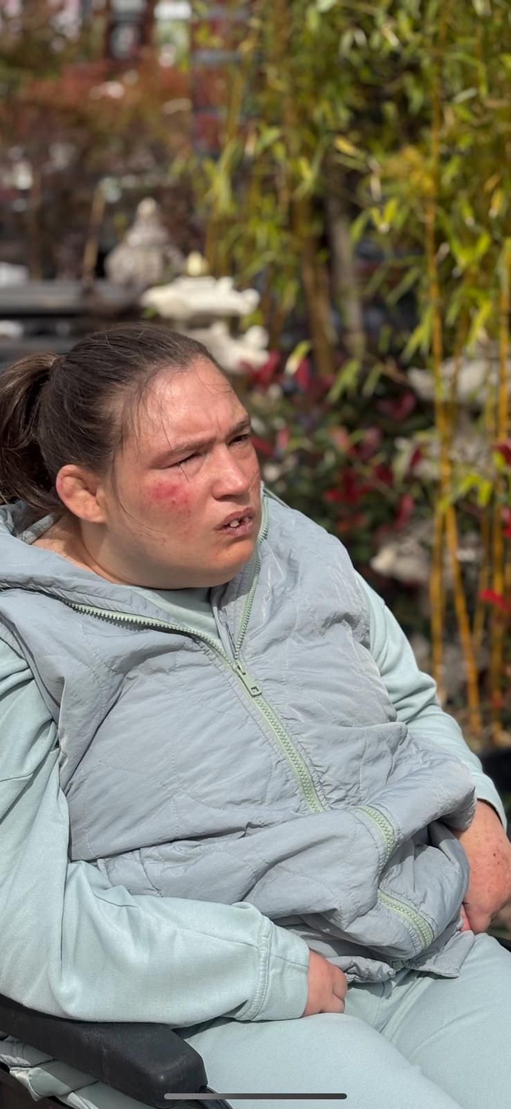 A person is seated in a wheelchair, wearing a light-coloured jacket and pants. Background is a garden setting.