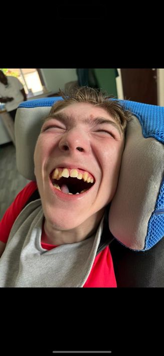 A person with a disability laughs widely. They are wearing a bib and sitting in a chair.