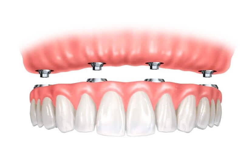 trattamenti dentistici
