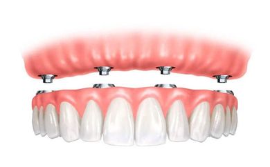 trattamenti dentistici