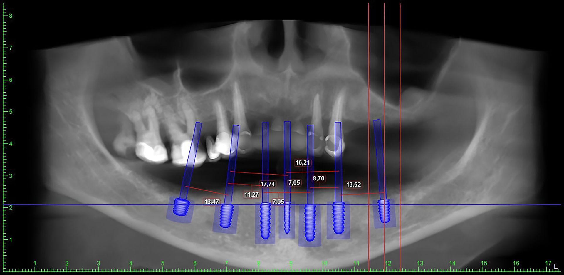 trattamenti dentistici