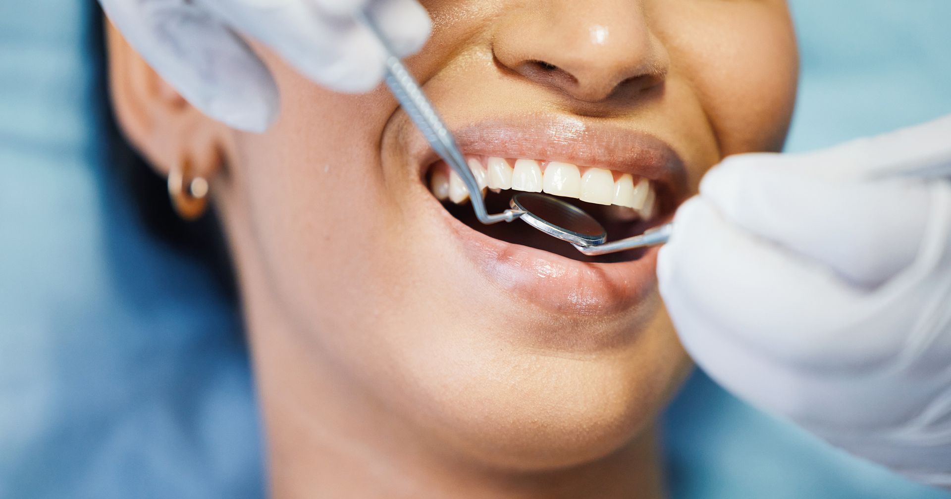 can bad teeth kill you