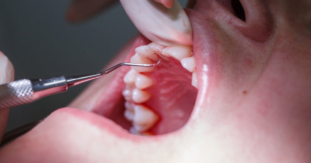 how can a dentist tell if you give oral