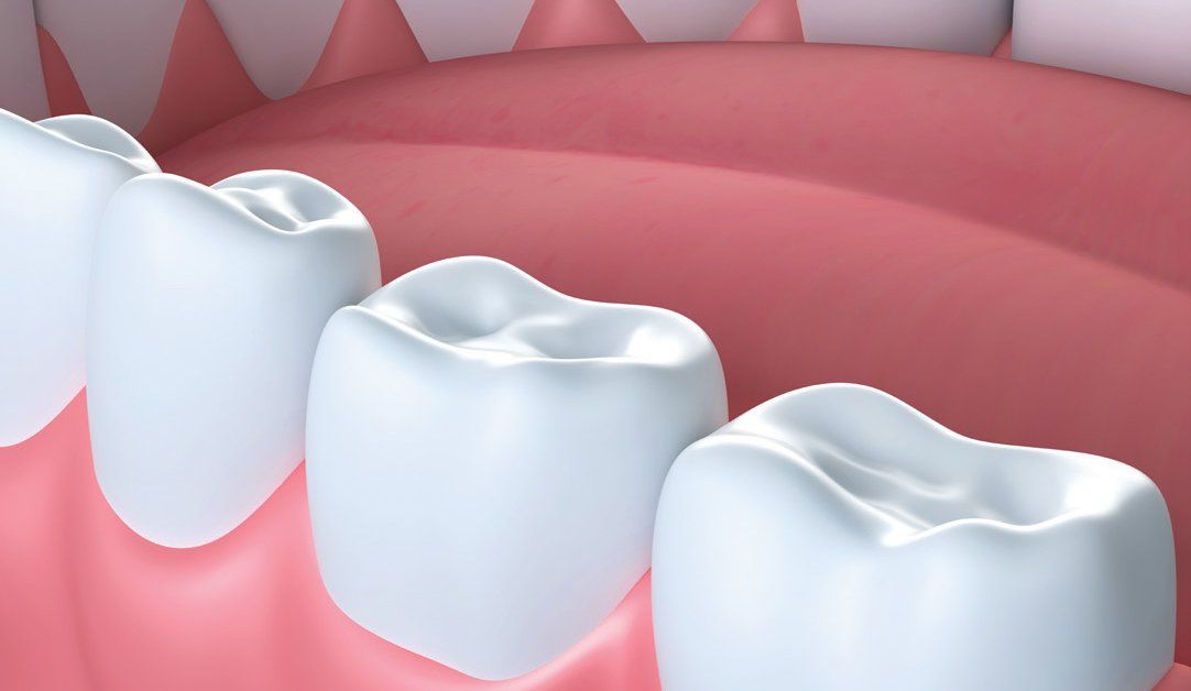 Dental Health Risks