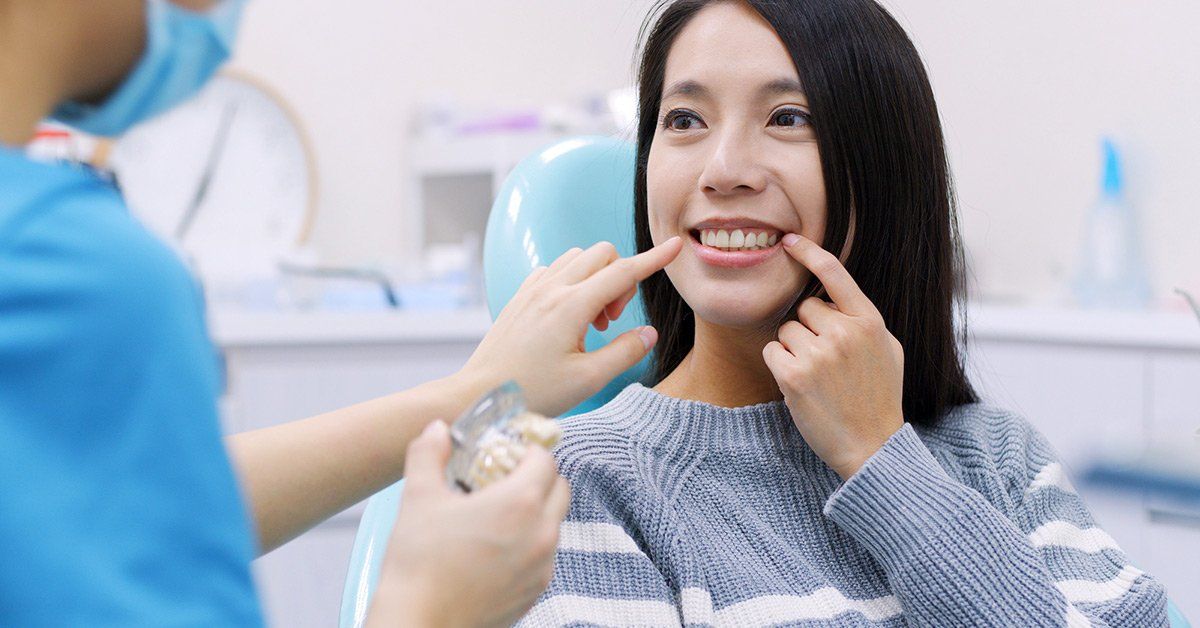 dental implants guide