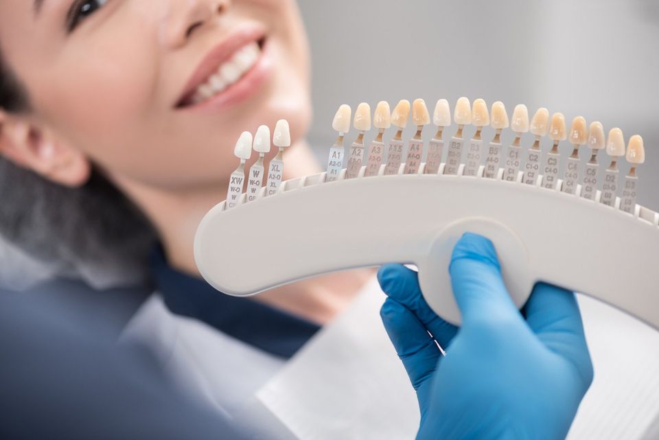 Veneers vs. Implants What's the Best Option?