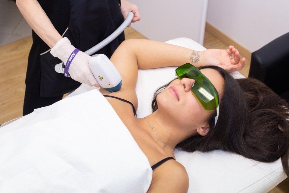 seduta di epilazione laser con diodo 808 per ascelle