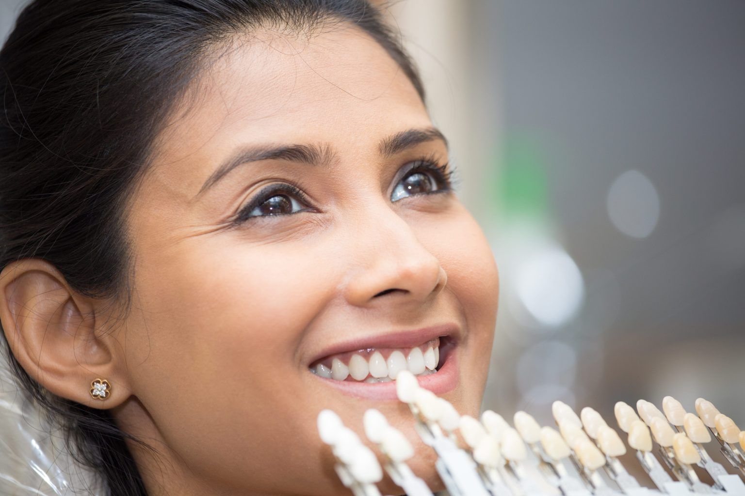 matching teeth color | Dental veneers in Monroe Township, NJ to repair and reshape teeth.