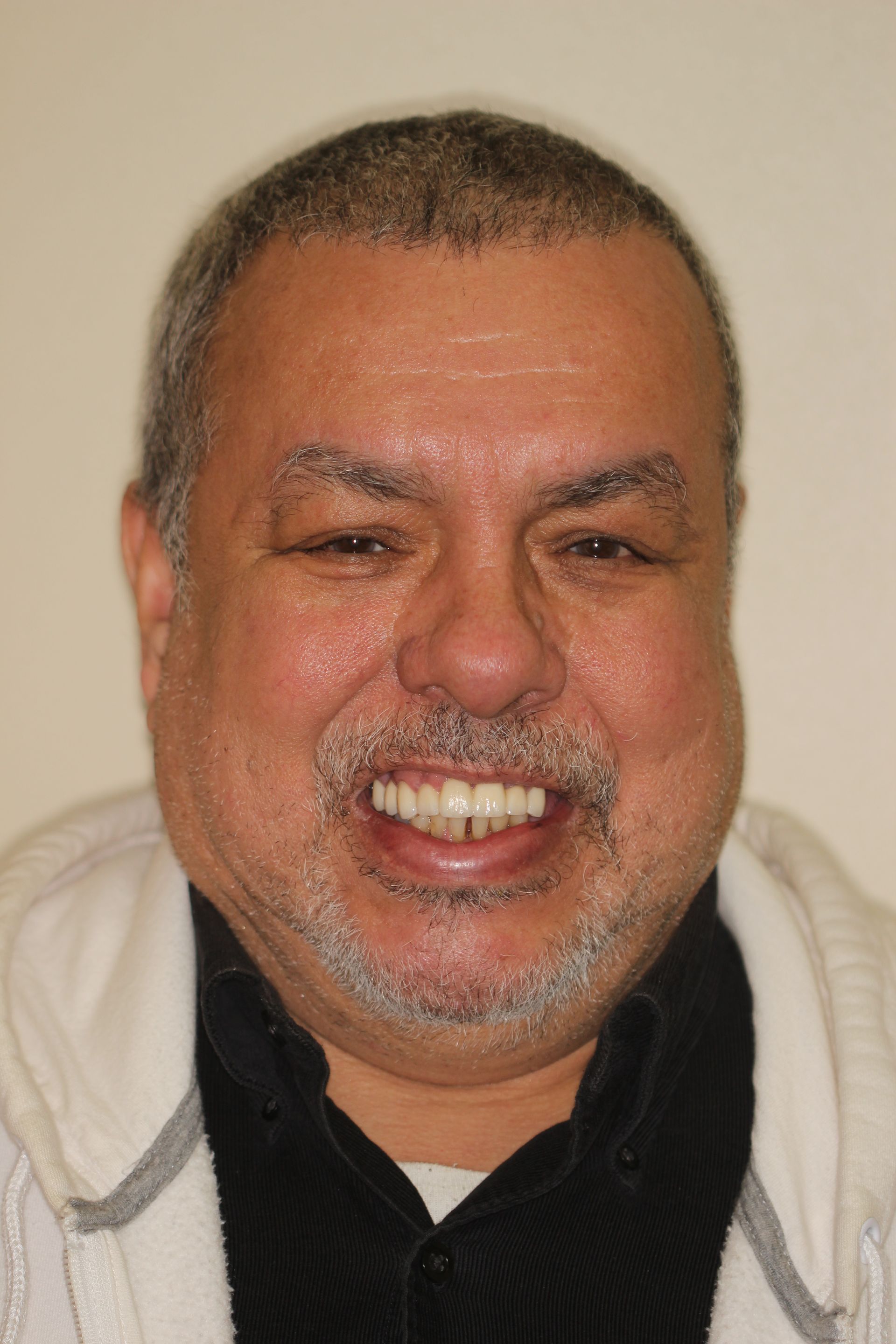 after dental veneers and crowns | man smiling | Dentists in Monroe and Highland Park 