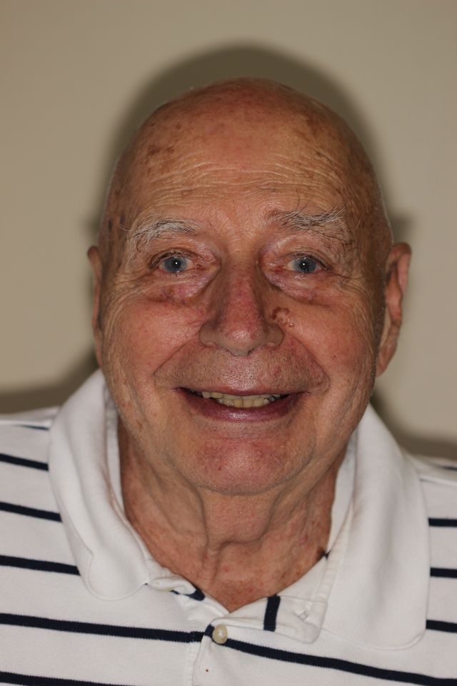 MAXILLARY FIXED HYBRID 4