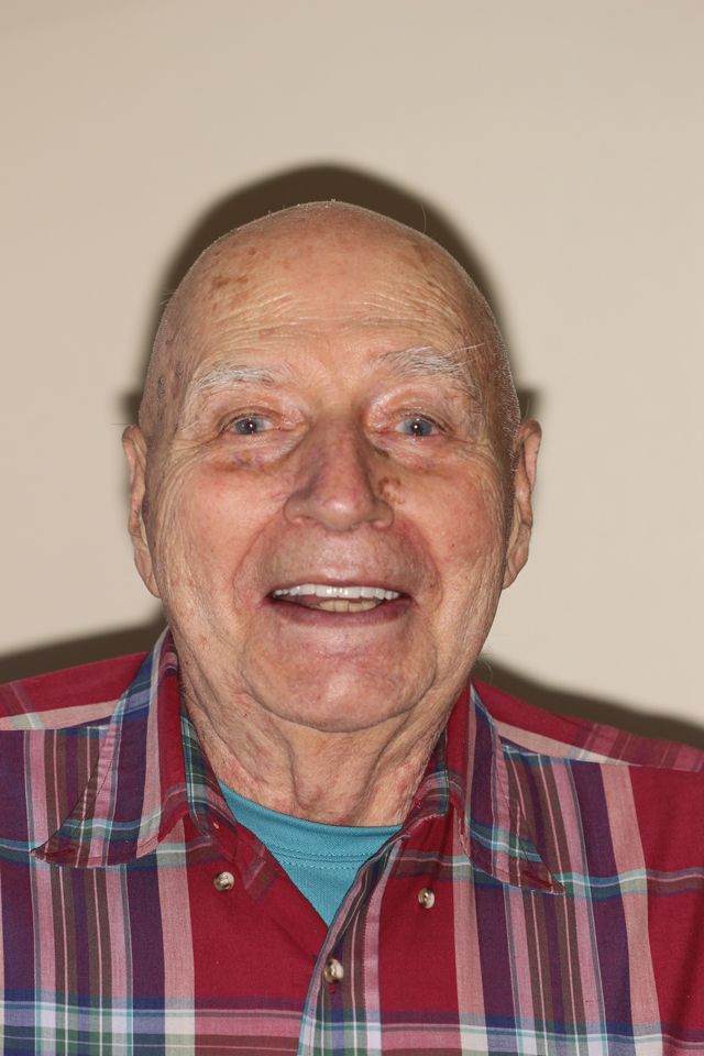 MAXILLARY FIXED HYBRID 4