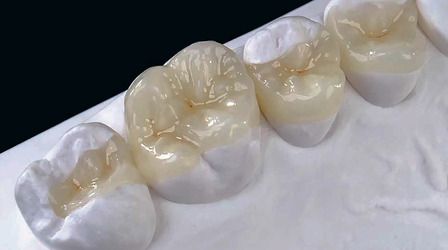 set of teeth