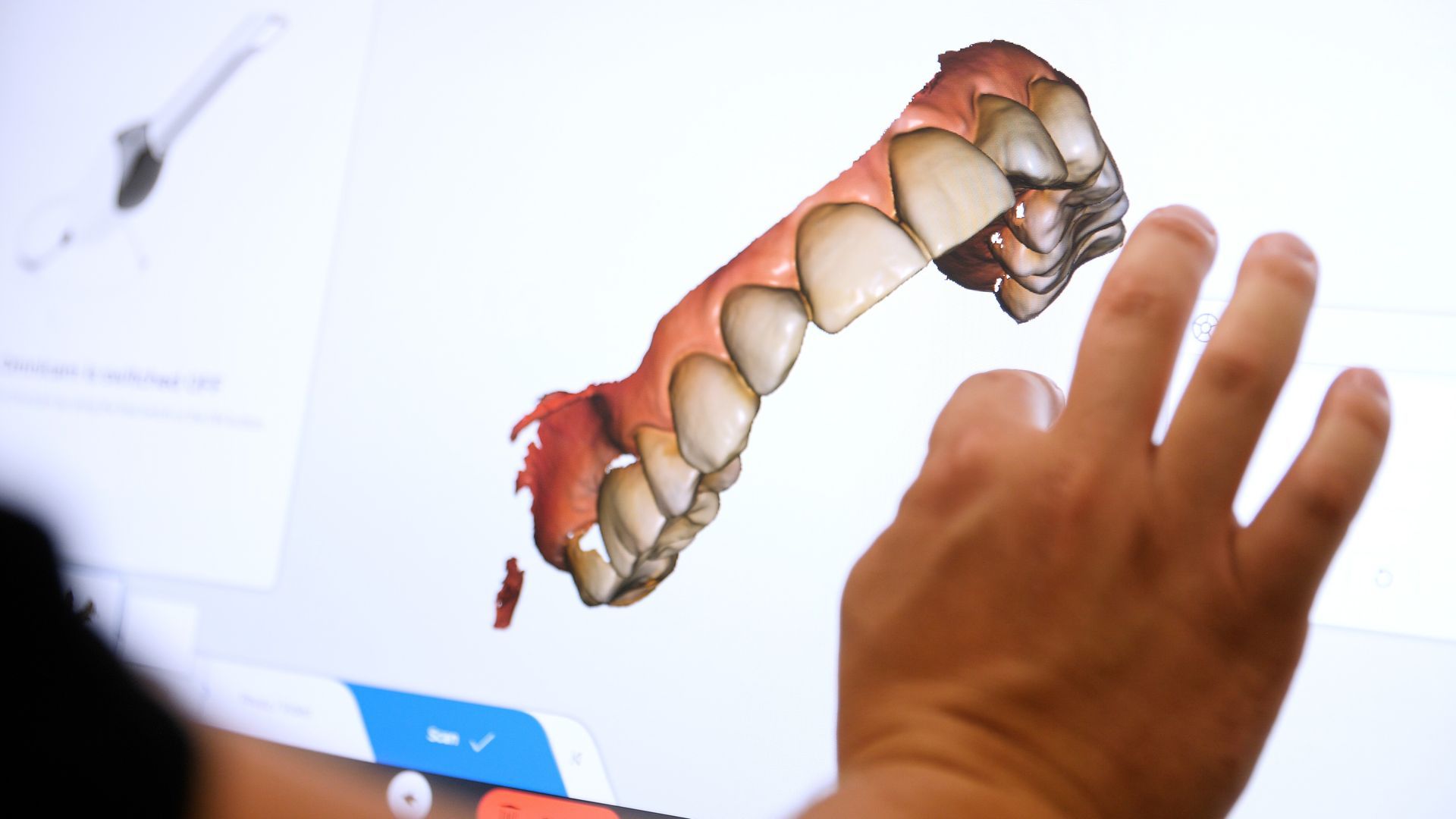 dental patient