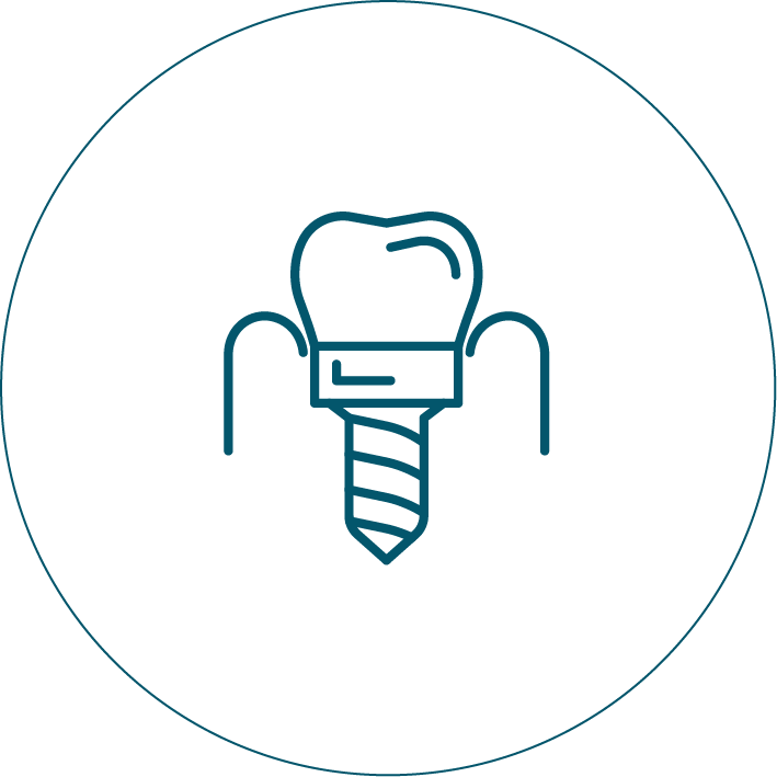 A line drawing of a tooth with a screw in it.