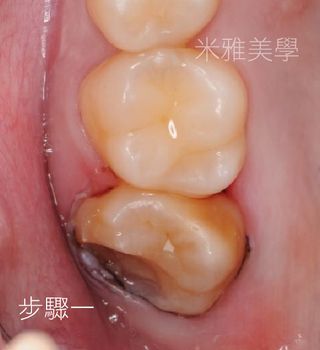 A close up of a person 's teeth with chinese writing on it.