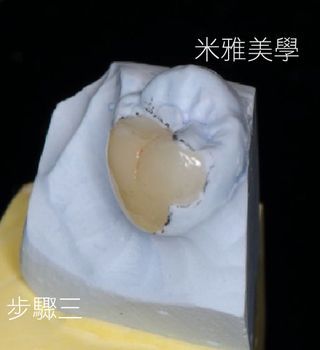 A model of a tooth with chinese writing on it