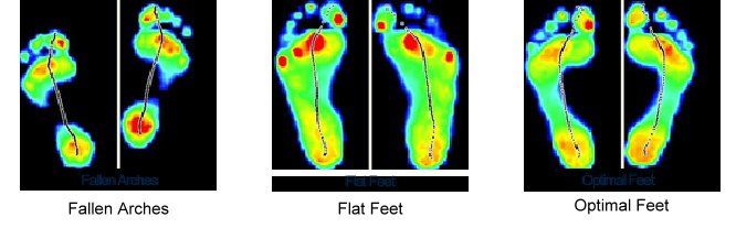 Orthotic images of client