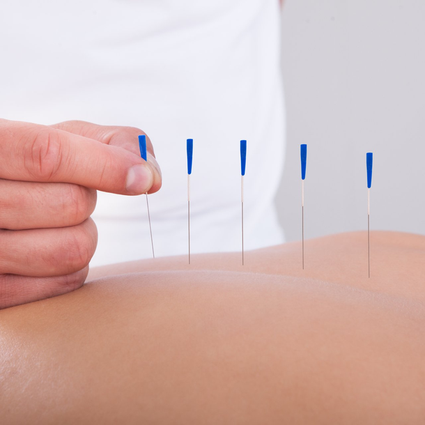 Acupuncture Services