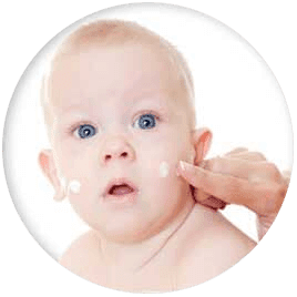 KIDIATRAS PEDIATRÍA GLOBAL - Dermatólogo pediátra