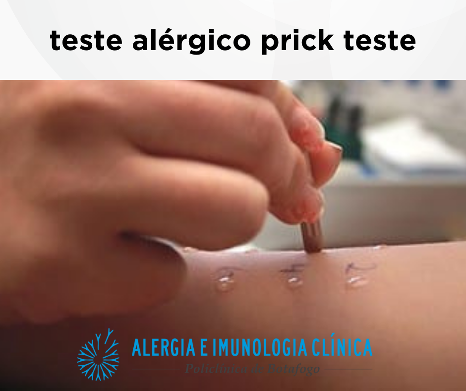 prick test em braço de paciente