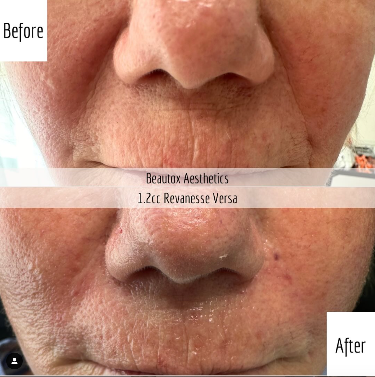 A before and after photo of a woman 's face