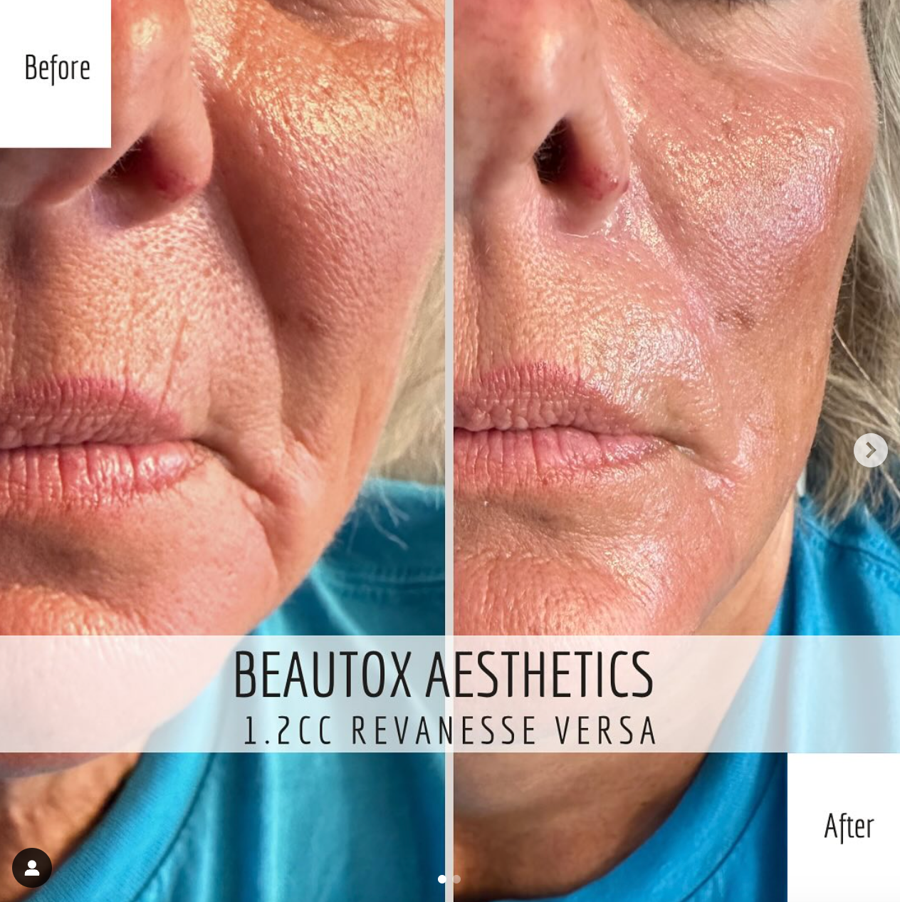 A before and after photo of a woman 's face