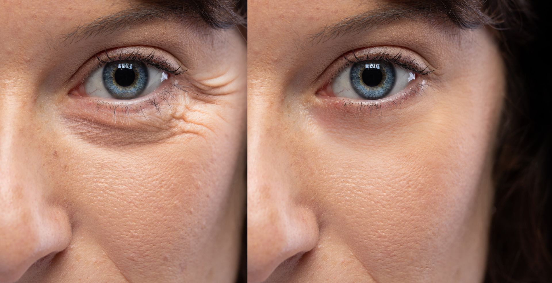A before and after photo of a woman 's eyes.