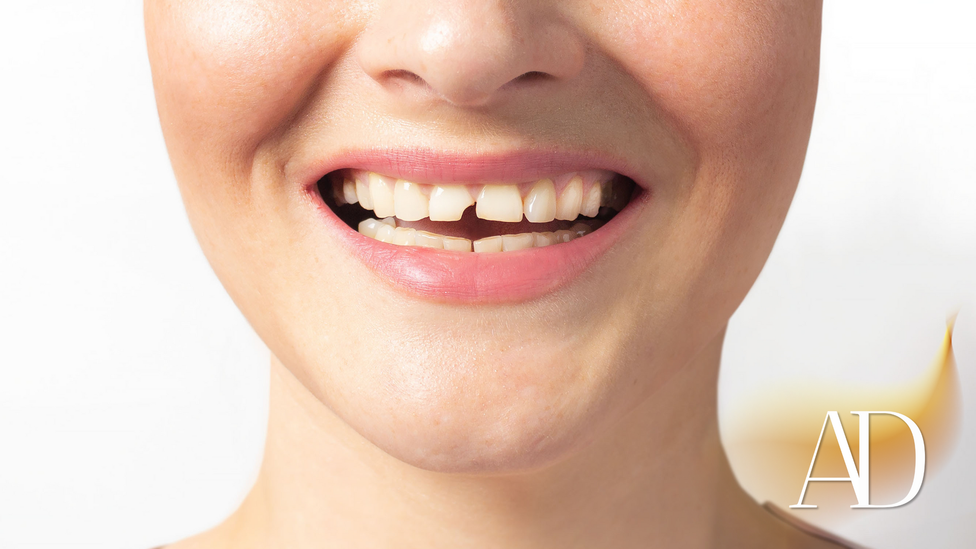 A close up of a woman 's mouth with a smile on her face.